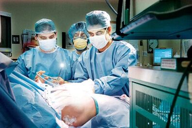 conduzindo uma operação para aumentar um membro