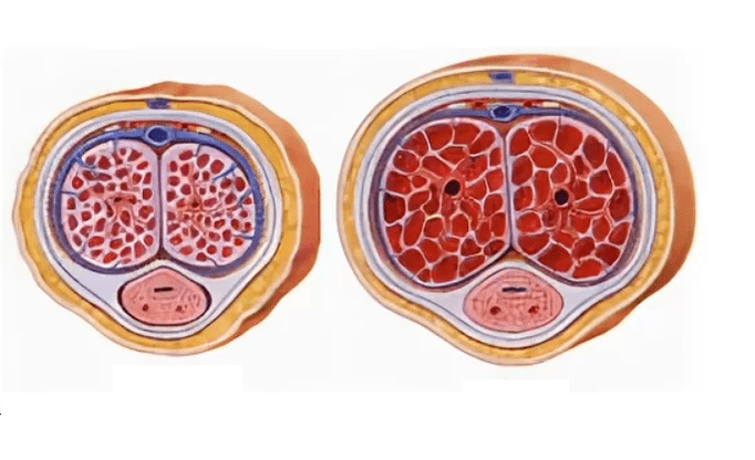 lipofilling para aumentar o pênis