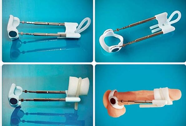 extensor para espessamento do pênis